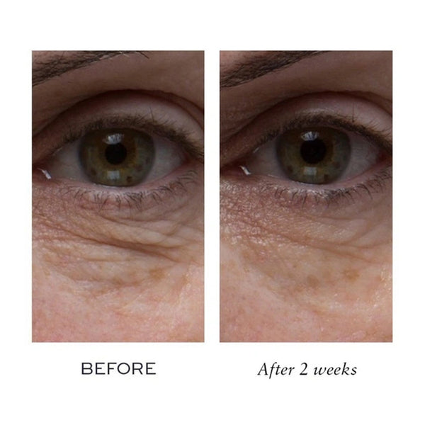 Elemis Peptide4 Eye Recovery Cream 15ml 0.5oz NIB Anti Aging Hydrating Eye Care